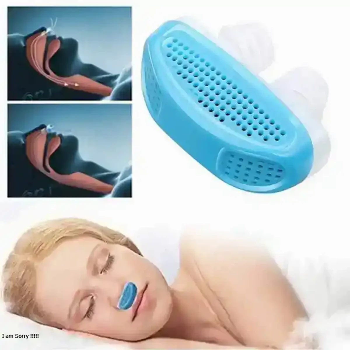 ANTI SNORING DEVICE